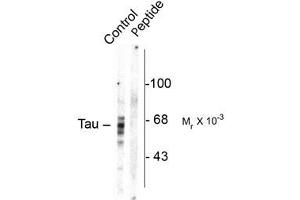 Western blots of rat brain homogenate showing specific immunolabeling of the ~59, 65, 68k Tau isoforms phosphorylated at Ser416(control). (MAPT antibody  (pSer416))