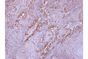 IHC-P Image Immunohistochemical analysis of paraffin-embedded Cal27 xenograft, using SIRT3, antibody at 1:500 dilution. (SIRT3 antibody  (C-Term))
