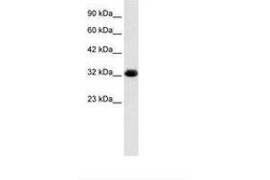 Image no. 1 for anti-Chromosome 22 Open Reading Frame 31 (C22orf31) (AA 113-162) antibody (ABIN202170) (C22orf31 antibody  (AA 113-162))