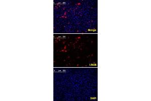 Confocal immunofluorescence analysis of methanol fixed HeLa cells were transfected with pMX construct of human LIN28, cells were analyzed ~62 hours after transfection. (LIN28A antibody  (AA 93-209))