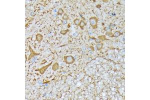 Immunohistochemistry of paraffin-embedded mouse spinal cord using CaMKII Rabbit mAb (ABIN3015112, ABIN3015113, ABIN1679768 and ABIN1679769) at dilution of 1:100 (40x lens). (CAMK2B antibody)