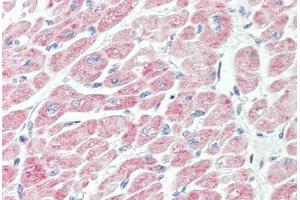 Anti-NLRX1 antibody IHC staining of human heart. (NLRX1 antibody  (AA 580-630))