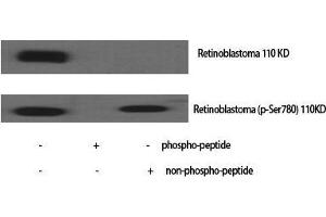 Western Blot (WB) analysis of specific cells using Phospho-Rb (S780) Polyclonal Antibody. (Retinoblastoma 1 antibody  (pSer780))