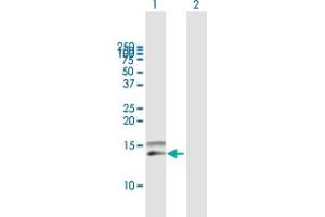Western Blot analysis of CCL28 expression in transfected 293T cell line by CCL28 MaxPab polyclonal antibody.