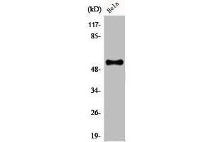 Western Blot analysis of HeLa cells using CREB3L2 Polyclonal Antibody