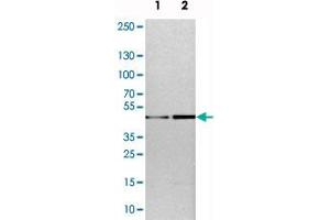 Western blot analysis of cell lysates with TOX polyclonal antibody .
