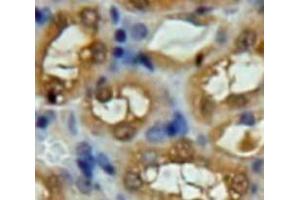 Used in DAB staining on fromalin fixed paraffin-embedded Kidney tissue (UCHL5 antibody  (AA 2-316))