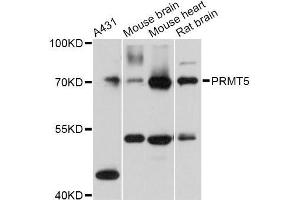 Western blot analysis of extracts of various cell lines, using PRMT5 Antibody (ABIN5970714) at 1:3000 dilution. (PRMT5 antibody)