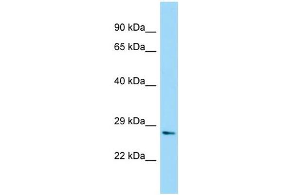 NUDT7 antibody  (N-Term)