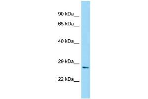 WB Suggested Anti-NUDT7 Antibody Titration: 1.