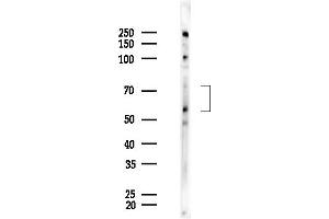anti-Colony Stimulating Factor 2 Receptor, Alpha, Low-Affinity (Granulocyte-Macrophage) (CSF2RA) (Internal Region) antibody