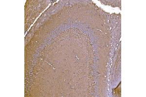 IHC analysis of P2X7/P2RX7 using anti-P2X7/P2RX7 antibody (ABIN7601815).