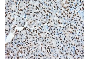 TACC3 antibody