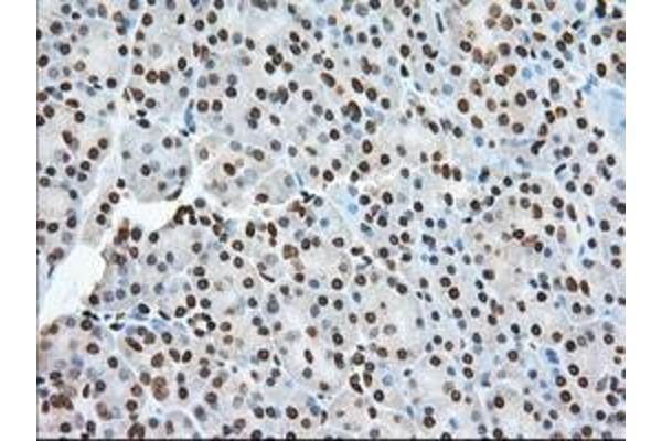 TACC3 antibody