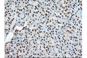 Immunohistochemistry (IHC) image for anti-Transforming, Acidic Coiled-Coil Containing Protein 3 (TACC3) antibody (ABIN1498096) (TACC3 antibody)