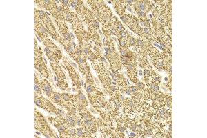 Immunohistochemistry of paraffin-embedded human liver injury using ATP5B antibody. (ATP5B antibody  (AA 230-529))