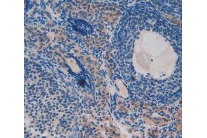 Used in DAB staining on fromalin fixed paraffin- embedded ovary tissue (PKIG antibody  (AA 1-76))