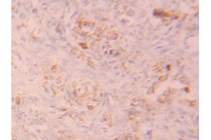 DAB staining on IHC-P; Samples: Human Ovary Tissue (FGFR1 antibody  (AA 236-362))