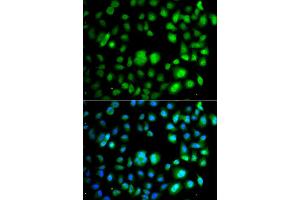 Immunofluorescence analysis of A549 cell using TET3 antibody.