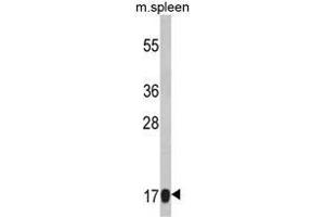Western blot analysis of RS18 Antibody (Center) Cat. (RPS18 antibody  (Middle Region))