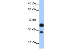 WB Suggested Anti-CITED2 Antibody Titration:  0. (CITED2 antibody  (N-Term))