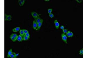 Immunofluorescent analysis of HepG2 cells using ABIN7147039 at dilution of 1:100 and Alexa Fluor 488-congugated AffiniPure Goat Anti-Rabbit IgG(H+L) (Cation Channel Sperm-Associated Protein Subunit epsilon (CATSPERE) (AA 601-832) antibody)