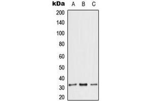 Western blot analysis of ANT3 expression in HeLa (A), Raw264. (SLC25A6 antibody  (Center))