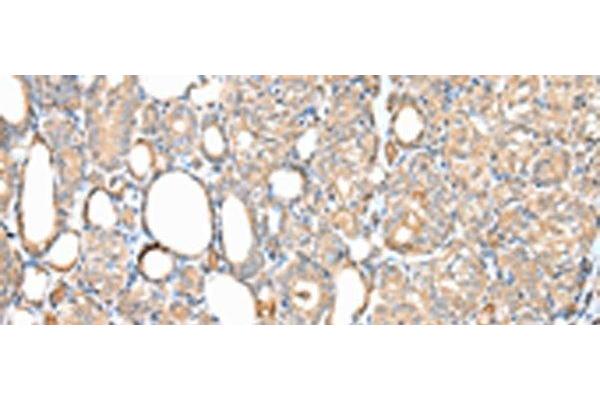 Diphthamide Biosynthesis 7 (DPH7) antibody