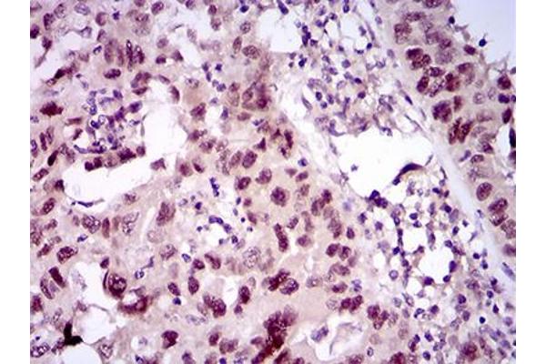 TP53BP1 antibody  (AA 574-773)