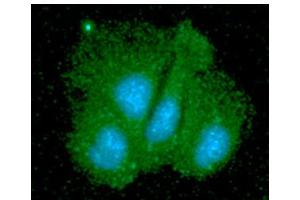 ICC/IF analysis of SGTA in Hep3B cells line, stained with DAPI (Blue) for nucleus staining and monoclonal anti-human SGTA antibody (1:100) with goat anti-mouse IgG-Alexa fluor 488 conjugate (Green). (SGTA antibody  (AA 1-313))