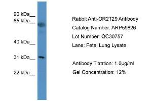 WB Suggested Anti-OR2T29  Antibody Titration: 0. (OR2T29 antibody  (C-Term))