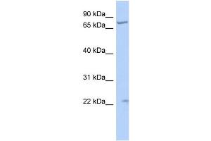 WB Suggested Anti-STRA6 Antibody Titration:  0. (STRA6 antibody  (N-Term))