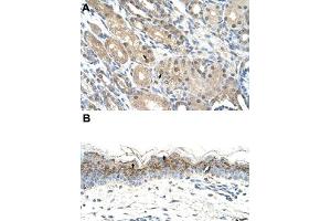 Immunohistochemical staining (Formalin-fixed paraffin-embedded sections) of human kidney (A) and human skin (B) with GEM polyclonal antibody  at 4-8 ug/mL working concentration. (GEM antibody  (C-Term))