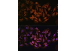 Immunofluorescence analysis of U-2 OS cells using CNBP antibody (ABIN7266165) at dilution of 1:100. (CNBP antibody  (C-Term))
