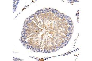 Immunohistochemistry of paraffin embedded mouse lung using MLF1 (ABIN7074712) at dilution of 1: 1500 (400x lens) (MLF1 antibody)
