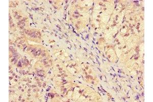 Immunohistochemistry of paraffin-embedded human adrenal gland tissue using ABIN7169176 at dilution of 1:100 (SGK1 antibody  (AA 247-406))