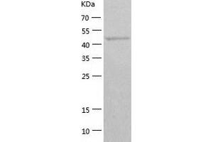 Western Blotting (WB) image for General Transcription Factor IIE, Polypeptide 1, alpha 56kDa (GTF2E1) (AA 1-439) protein (His tag) (ABIN7285865) (GTF2E1 Protein (AA 1-439) (His tag))