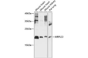 Western blot analysis of extracts of various cell lines, using MRPL22 antibody (ABIN7268563) at 1:1000 dilution.