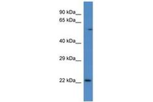 Image no. 1 for anti-RAB10, Member RAS Oncogene Family (RAB10) (C-Term) antibody (ABIN6746005) (RAB10 antibody  (C-Term))