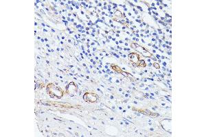 Immunohistochemistry of paraffin-embedded human appendix using M antibody (ABIN3017162, ABIN3017163, ABIN3017164, ABIN1680735 and ABIN1680736) at dilution of 1:100 (40x lens). (MADCAM1 antibody)