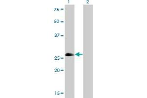 Western Blot analysis of ASCL1 expression in transfected 293T cell line by ASCL1 monoclonal antibody (M01), clone 7E11. (ASCL1 antibody  (AA 137-236))