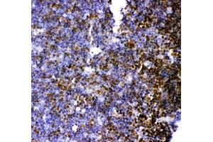 Anti-MCAK antibody, (ABIN3043278), IHC(P)IHC(P): Rat Thymus Tissue (KIF2C antibody  (AA 531-725))