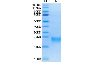 Biotinylated Human BAFFR on Tris-Bis PAGE under reduced conditions. (TNFRSF13C Protein (His-Avi Tag,Biotin))