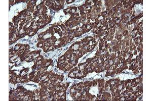 Immunohistochemistry (IHC) image for anti-Acetyl-CoA Acyltransferase 2 (ACAA2) antibody (ABIN1495723) (ACAA2 antibody)