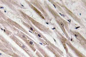 Immunohistochemistry (IHC) analyzes of Caspase12 antibody in paraffin-embedded human heart tissue. (Caspase 12 antibody)