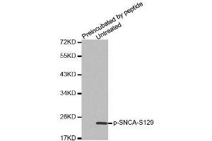 Western blot analysis of extracts from mouse brain tissue, using Phospho-SNCA-S129 antibody (ABIN2988301). (SNCA antibody  (pSer129))
