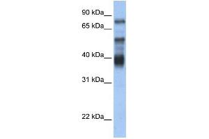 WB Suggested Anti-ZNF395 Antibody Titration:  0.