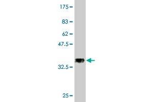 Western Blot detection against Immunogen (37. (SESN3 antibody  (AA 212-321))