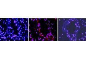 Immunofluorescence microscopy after staining of mouse carotid artery tissue with anti-Mouse IL-1ß antiserum (less purified form of ) diluted 1:50. (IL-1 beta antibody)