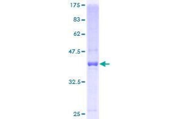 C19orf10 Protein (AA 32-173) (GST tag)